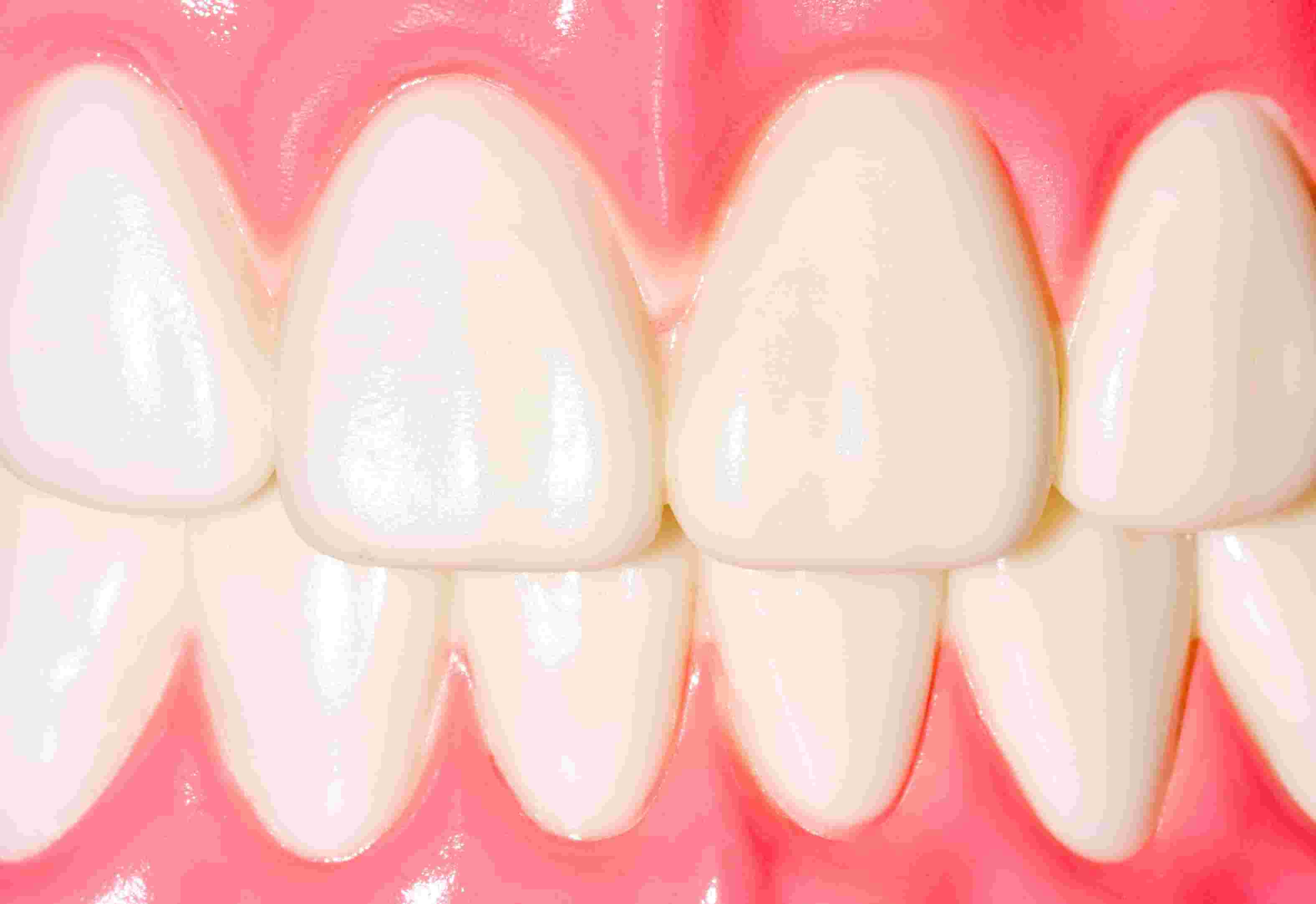 Tooth Pain: DON?? Just Ignore It. Here?? Why - SCHULTZ