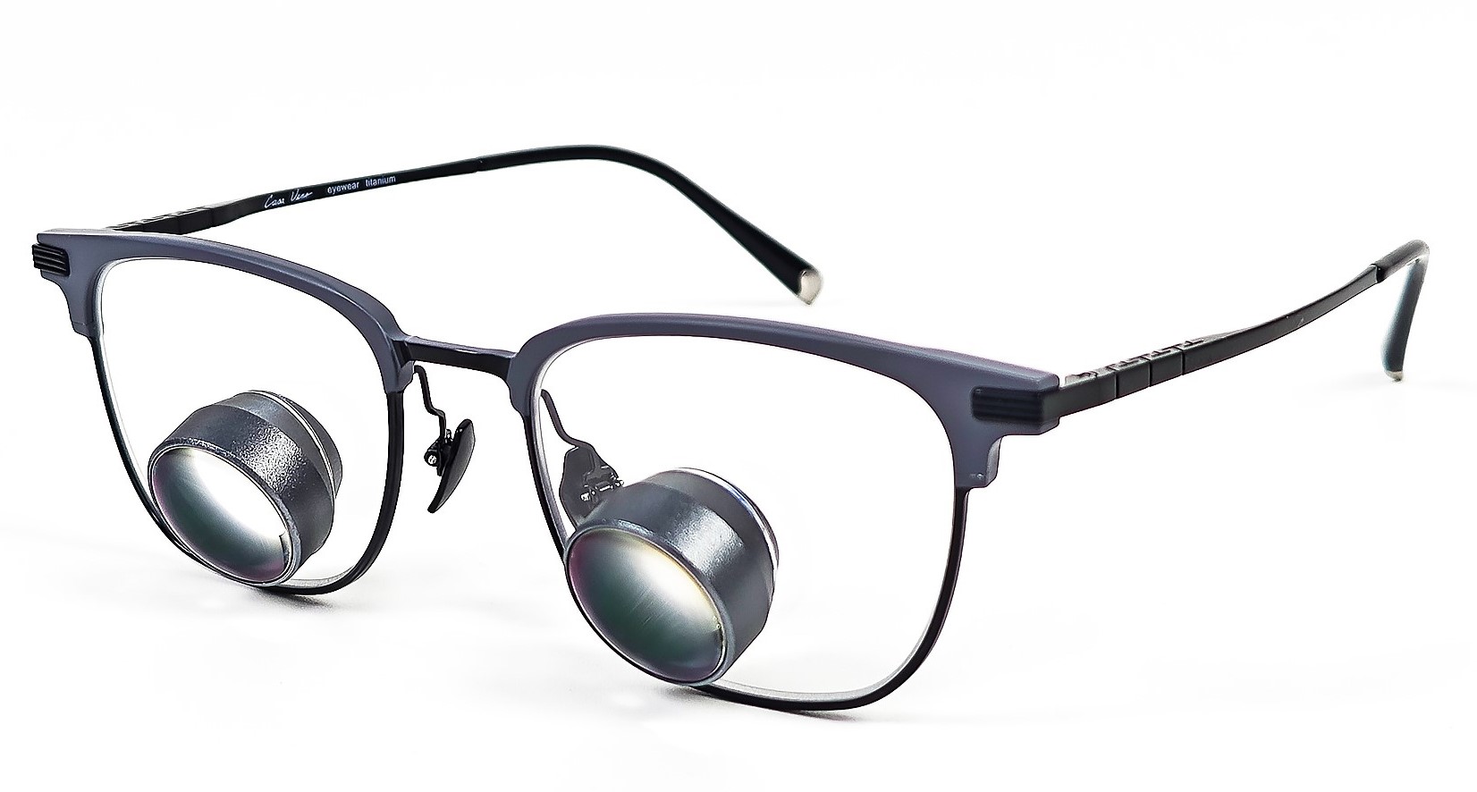 Ultra View Mini Dental Surgical TTL Loupes 2.5x | Super Light | Large Field